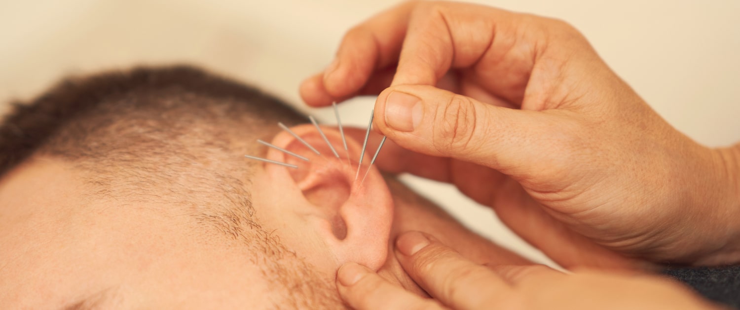 Veerkracht & Voeding acupunctuur