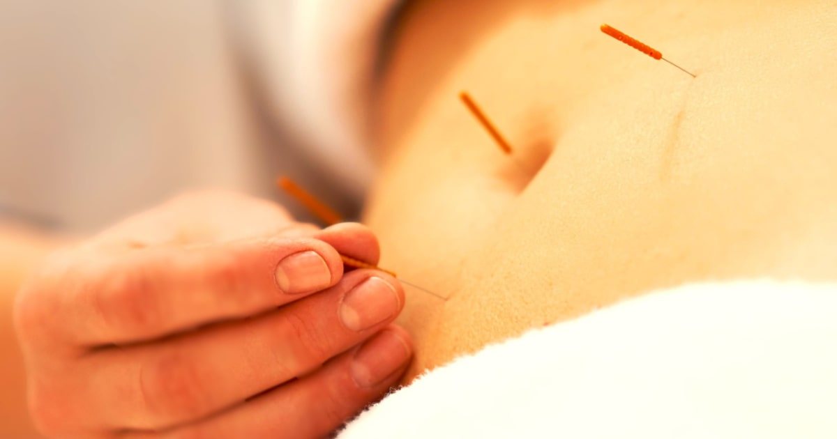 Veerkracht & Voeding acupunctuur