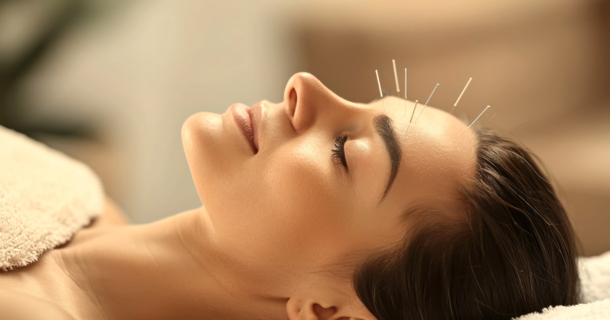 Veerkracht & Voeding cosmetische acupunctuur